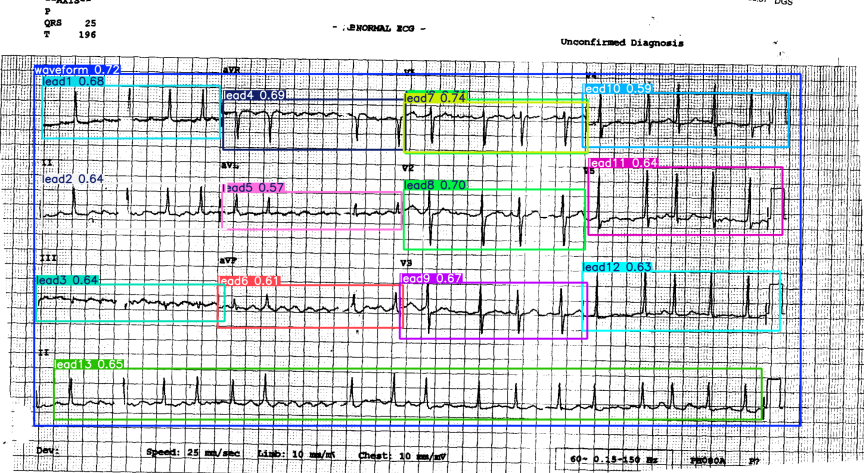 ECG Paper Demo 1