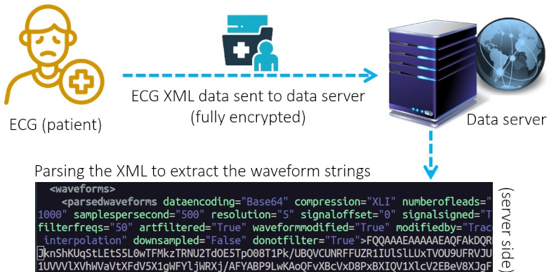 ECG XML Demo 1