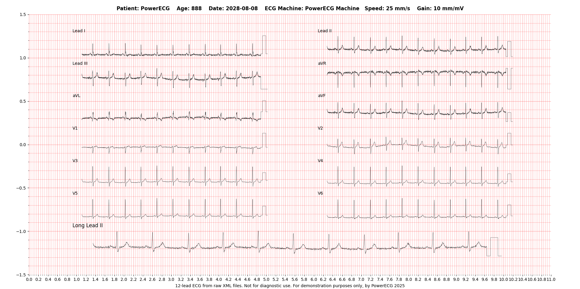 ECG XML Demo 2