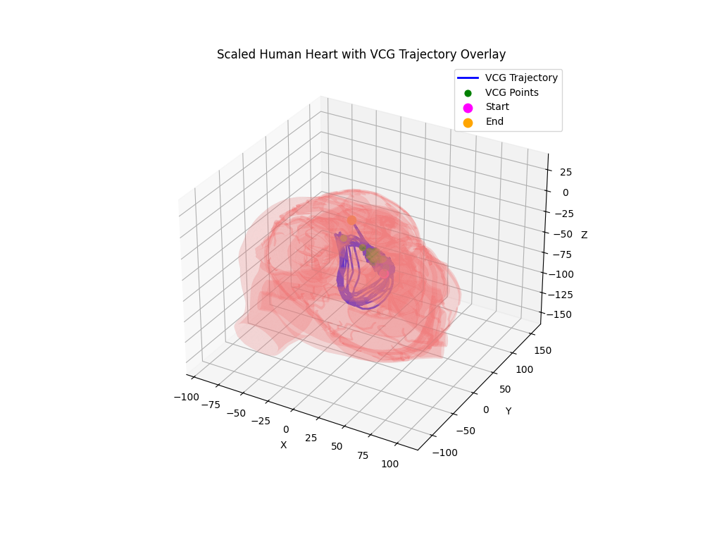 ECG XML Demo 3