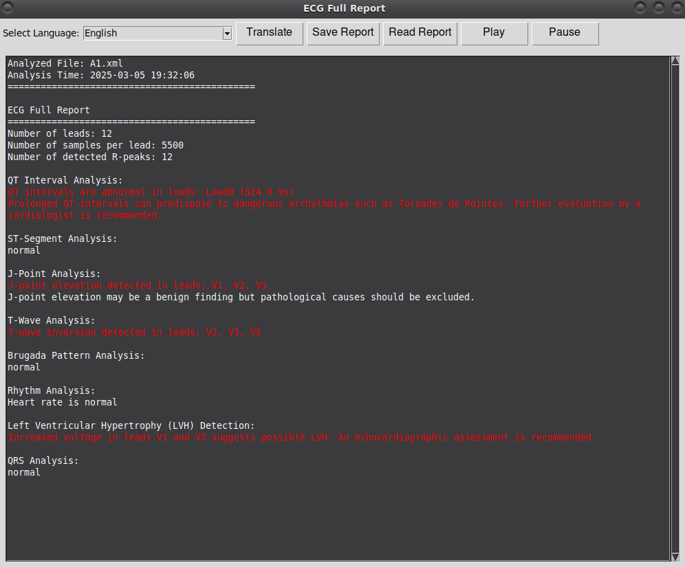 ECG XML Demo 4