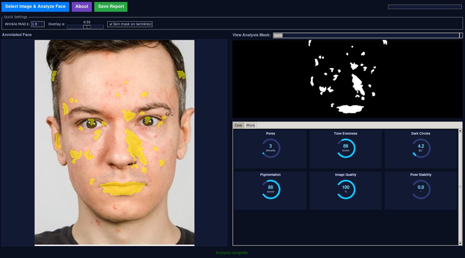 Skin Analysis Demo 1