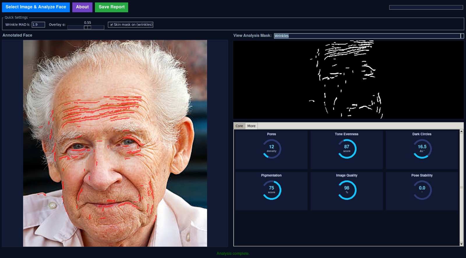 Skin Analysis Demo 2